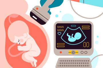 University of Sheffield &ndash; Placenta abnormalities diagnosis