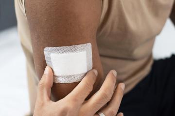 Fibre wound dressings for the management of exudated wounds
